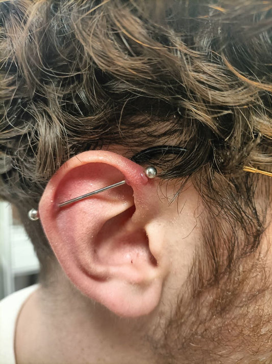 Comment soigner une excroissance à l'oreille ?