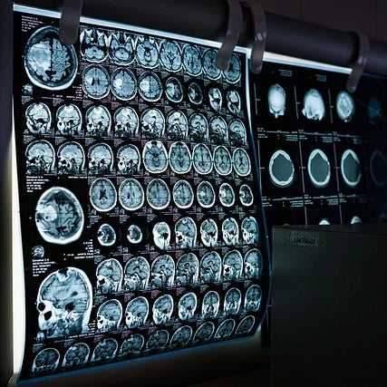 IRM / radio / opération : dois-je retirer mon piercing en titane ?