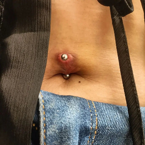 Rejet piercing nombril